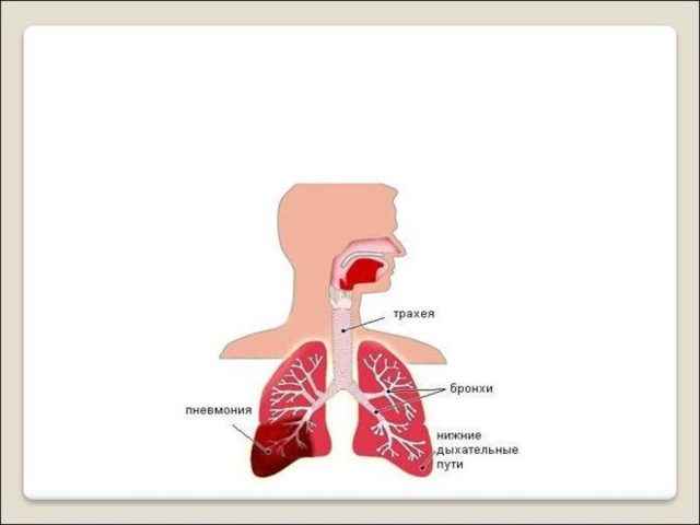 056be9f8251ad2e9970ab82e35dbac25 1 - Левосторонняя нижнедолевая пневмония: симптомы, причины возникновения и лечение, если болен ребёнок