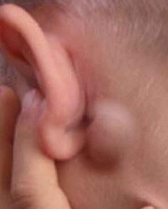 0bc71aa810f23b06a40011875ca1a04a 1 - Боль в ушах: почему возникает и как лечить