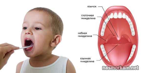 1ec9782dceb9c945946dbb8c7e735fc1 1 - Особенности лечения увеличенных миндалин у ребенка: причины, симптомы, лечение и фото