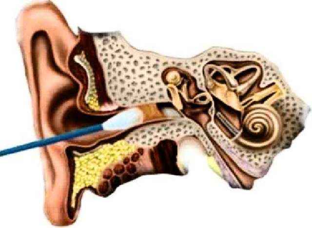 23957224ea5839ccfb98e4c1f05f8d6f 1 - Пульсирует в ухе: причины стука и пульса в органах слуха, почему бьется в ухе пульс, но не болит?