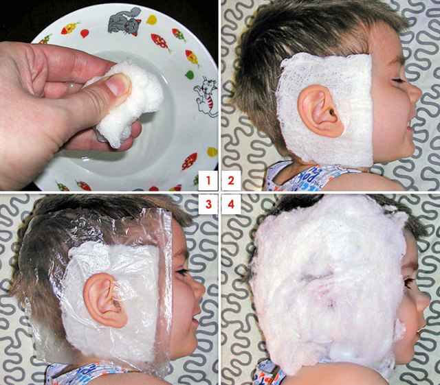 29a41ecb456dda9487a0bd82605fc70f 1 - Компресс для уха: как сделать спиртовую и водочную повязку при отите, компрессорное лечение на ухо ребенку
