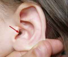2c766fff4698d7351b85c6cd8d94e61e 1 - Корочки в ушах, сухие уши и шелушение ушей: причины и методы избавления
