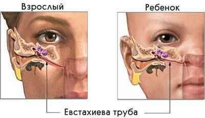 335fce4884ab3cdeed9b00778943a500 1 - Суспензия гидрокортизона, мазь и капли в ухо — способ применения, дозировка и противопоказания