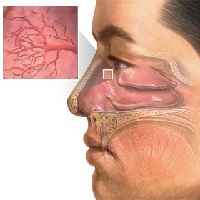 38874f02a38162d198451b6c69695e18 1 - Что значит гиперемирована слизистая носа: воспалённые слизистые носа и терапия, реструктуризация оболочек носа
