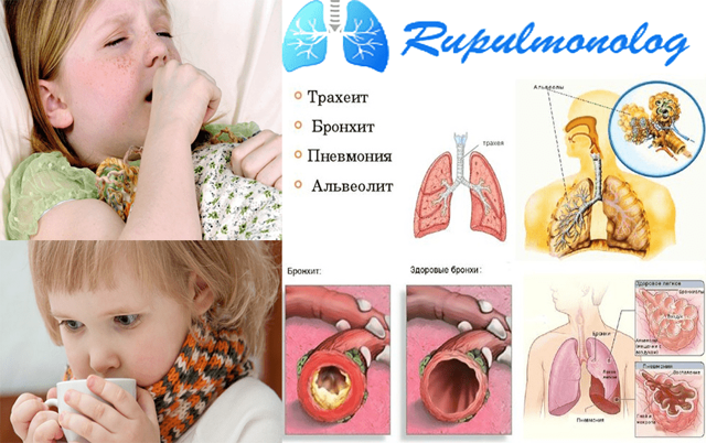3a89688ca58dfe56970e36bfd4c4f18d 1 - Физраствор для промывания носа новорождённому: инструкция и преимущества натрий хлорида в борьбе с простудой
