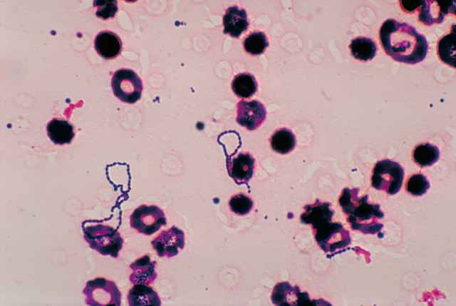 3c00a92efe4f20fda0f96c23c284b48c 1 - Стрептококк вириданс: что за бактерия, какие инфекции вызывает, диагностика и лечение streptococcus viridans