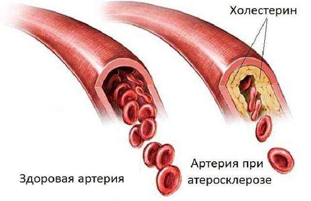 49e973487509ad625327e754c785bc11 1 - Пульсирует в ухе: причины стука и пульса в органах слуха, почему бьется в ухе пульс, но не болит?
