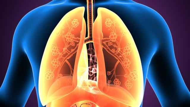 5ae7e5c453c65115c534ed97a49ddb6c 1 - Плеврит лёгких: особенности, симптомы, а также лечение и профилактика воспаления