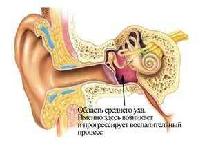 5da49cb74dab77ffaab564f342b04560 1 - Заложенность уха при насморке: причины, лечение, профилактика