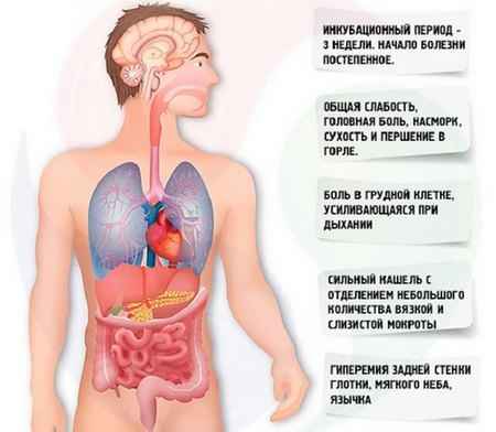 6149073797f2e9268c950d966ee85f51 1 - Правосторонняя пневмония: причины воспаления легких справа, лечение верхнедолевой и нижнедолевой пневмонии