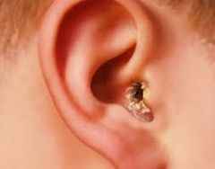 66ab869ea37100a6b7932b64dac24126 1 - Особенности лечения заболеваний уха: виды капель, что лучше, отинум или отипакс