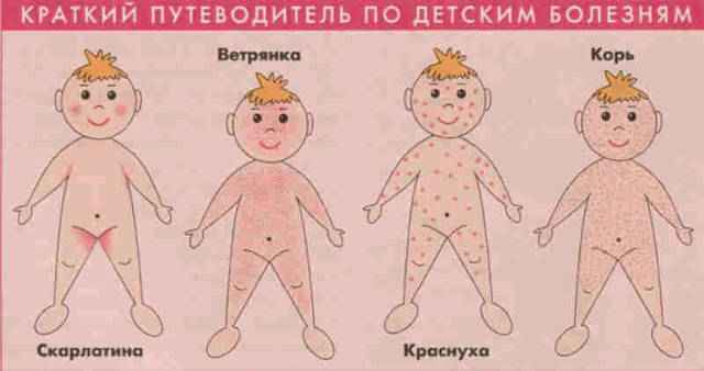 868f42680511f1653cc37c0335b26566 1 - Сыпь на теле у ребёнка без температуры: как выглядит сыпь и от чего она бывает