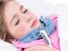 8f73eade3b7aebe277514e56bdb2225c 1 - Особенности лечения скарлатины у ребенка: признаки и симптомы, формы, лечение