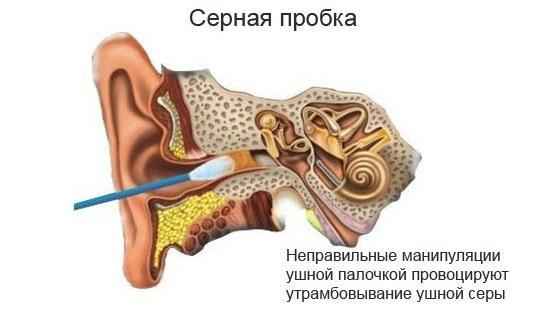 90447ffd0de8a5c863b20f220e4b13b7 1 - Заложенность уха при насморке: причины, лечение, профилактика