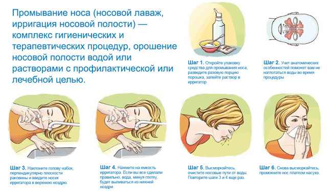 95209eb79dad510a5866b3125a886b34 1 - Как правильно промывать нос при гайморите в домашних условиях