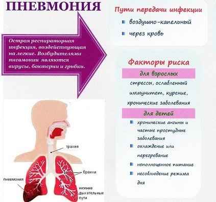 9f0088a556032ee4030d0830bfed1bfa 1 - Правосторонняя пневмония: причины воспаления легких справа, лечение верхнедолевой и нижнедолевой пневмонии
