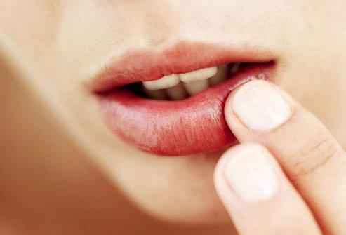 a3d8a264289087fc73530d97897339de 1 - Как избавиться от простуды на губах? чем лечить быстро и простуду на губах?