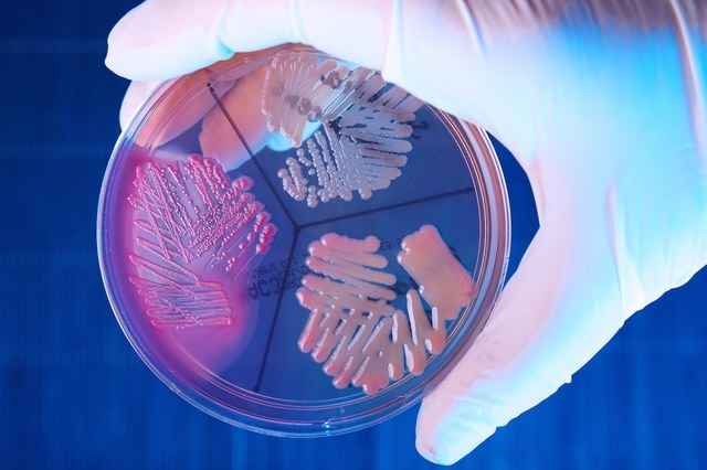 ab50d0f1286032949f720c32333bfc67 1 - Клебсиелла: бактерии klebsiella в органах человека, в моче, кале и дыхательных путях