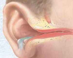 add17154dd94b7d6af64388b2103d6b8 1 - Что такое отит: воспаление среднего уха, симптомы, виды и лечение