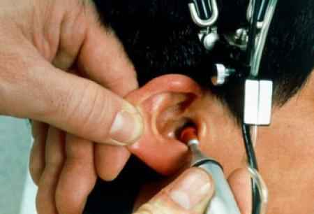 b47eb4f2d88929daf6491163cd3f1b16 1 - Особенности применения капель для ушей при воспалении: симптомы воспаления, лечение
