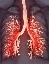 b58e65084e183140021c796550877c00 1 - Плеврит лёгких: особенности, симптомы, а также лечение и профилактика воспаления