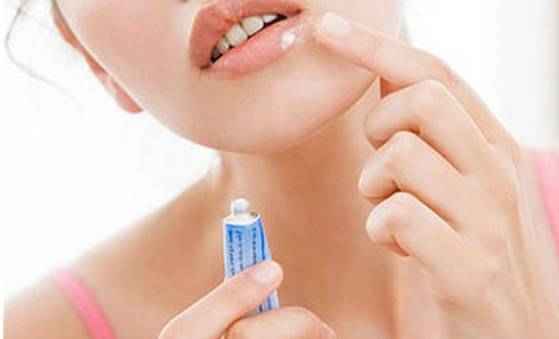 b5d37b7323576a87c328e67a87346d97 1 - Как избавиться от простуды на губах? чем лечить быстро и простуду на губах?