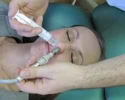 b75b547110d3e325cd8a2f533f89cf54 1 - Показания к эндоскопии носа и носоглотки у ребенка, зачем ее делают? когда делают эндоскопию носоглотки детям