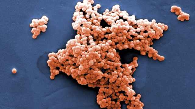 c29ca39117f6a96cc5b19b79f6c6a342 1 - Что это такое streptococcus pyogenes: причины, лечение митис, оралис и пиогенес стрептококков