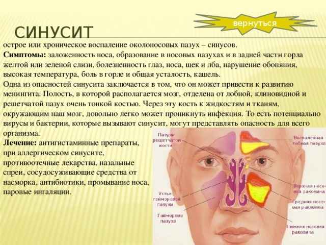 c5266d9a505af093455c9f0ee5a318e1 1 - Что такое синусит: причины и симптомы заболевания, отличия синусита от гайморита и способы лечения