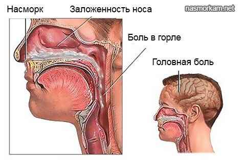 ca6a8f00cb598c9951761faf8ebb0b1b 1 - Что такое сопли, откуда они берутся в носу, из чего состоят и какую функцию выполняют?