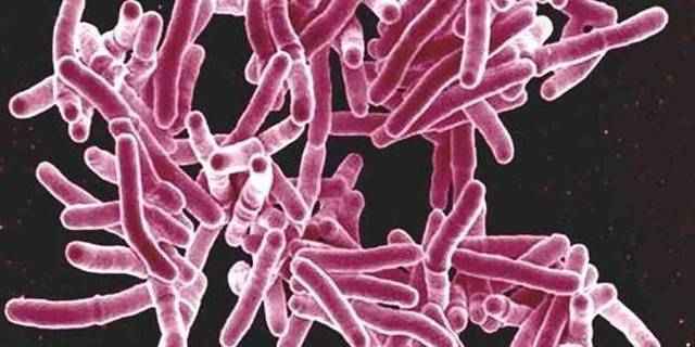 caed0a5479ed52a6379b056fff1be87b 1 - Туберкулезная болезнь: как лечить и как избежать заболевания, профилактика бактерии туберкулеза, палочки коха
