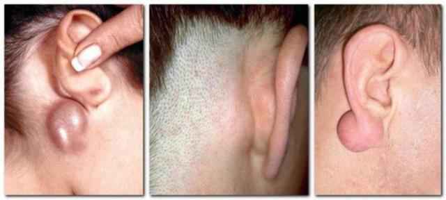 ce153969e4a5c109bb32915a9b8490da 1 - Боль в ушах: почему возникает и как лечить