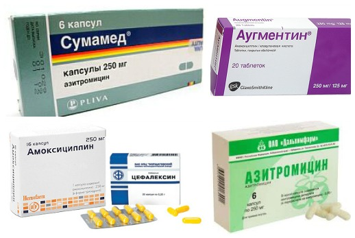 Какие лекарства принимать при заболевании