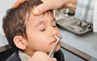 da38b5e9b7be8a8caa7de598ca49756d 1 - Использование глазных капель левомицитиновые в нос при насморке у детей