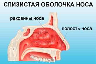 dd5aaeffab283a658d06a690e39b2eeb 1 - Симптомы воспаления слизистой оболочки носа: в чем заключается лечение