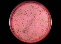 ddb011f5d1ef4e2b0fc580cef47887d8 1 - Стрептококк вириданс: что за бактерия, какие инфекции вызывает, диагностика и лечение streptococcus viridans
