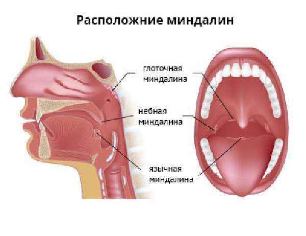 e237e9010e86c8a9237b9d22cd82f9be 1 - Миндалины: как выглядят здоровые миндалины в горле, воспаление миндалин, лечение горла