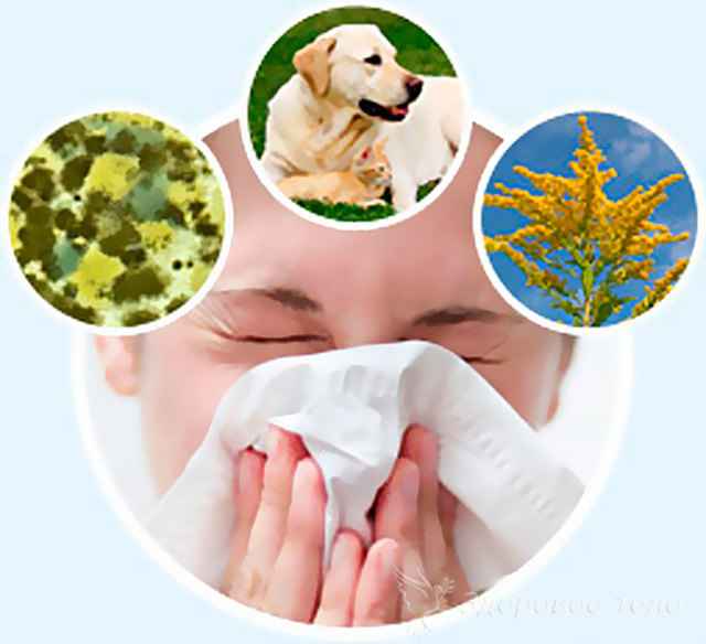 e552d1d9b7ceece30eac2e5aeb9a98b5 1 - Что такое аллергический насморк: симптомы и чем лечить ринит