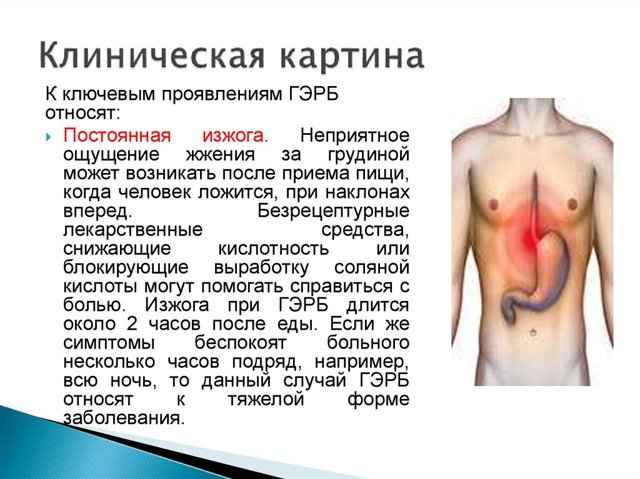 e652e00b37a70dd5710b096f76cd4987 1 - Боль и заложенность за грудиной, ком в горле и сухой кашель