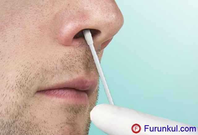 e8beae7ca6889f2bea6e259bd04db059 1 - Фурункул в носу: причины появления и симптомы фурункулеза, фото, как лечить чирей