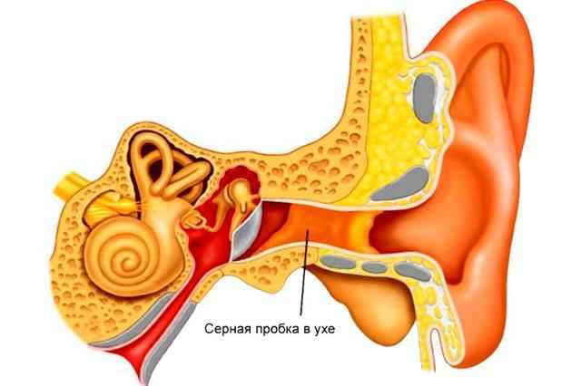 e92b4625a184b52c341edb0c45886acd 1 - Заложенность ушей без боли, в чём причины избавление лечение