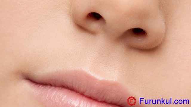 f3f342ae3d9d8b24ac242b640cdb81a5 1 - Фурункул в носу: причины появления и симптомы фурункулеза, фото, как лечить чирей