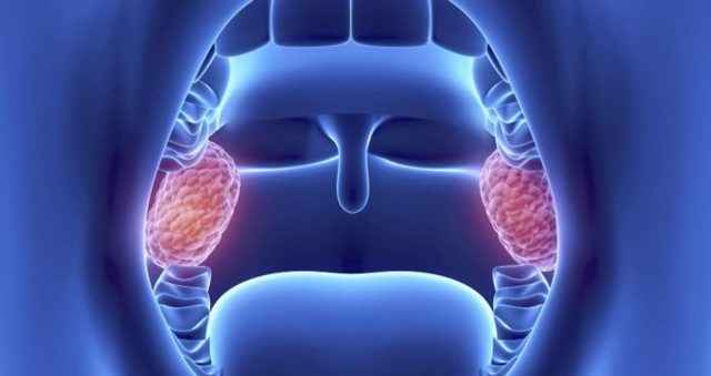 f7db3fc81948aae5e419bd547af5b6fa 1 - Миндалины в горле: основные причины, симптомы и лечение воспаления глоточных и небесных миндалин