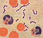 f83373f9c4e35e485de34b50d87f2033 1 - Особенности лечения гемолитического стрептококка: причины и симптомы появления streptococcus, лечение