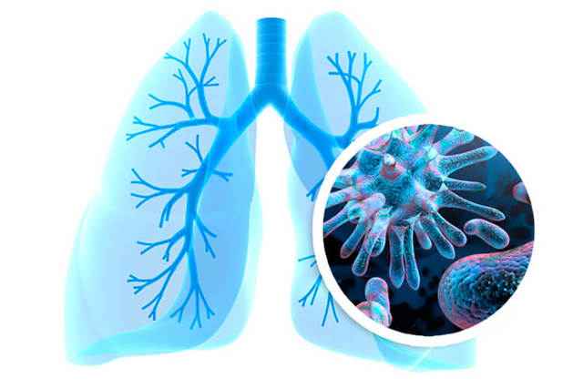 fe4f2595c721e8f4339af8e33811ea18 1 - ОРВИ (острая респираторная вирусная инфекция) – заболевание дыхательных путей