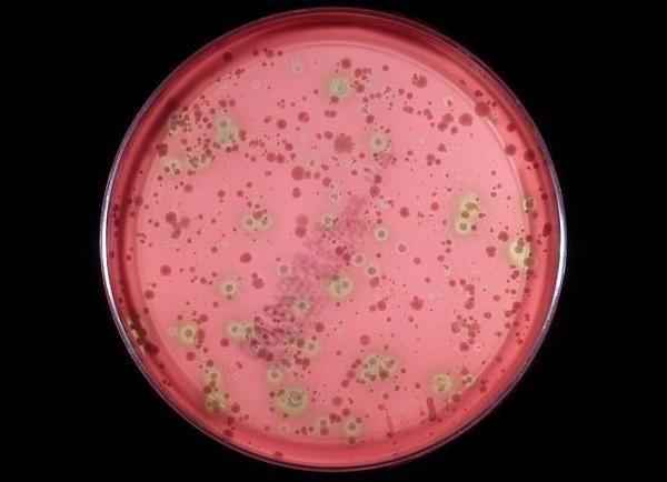 fe65a2cd1533de5a9b165c8a9926b35d 1 - Стрептококк вириданс: что за бактерия, какие инфекции вызывает, диагностика и лечение streptococcus viridans