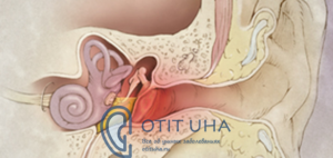 Seroznyj otit 300x142 1 - Анатомия гортани человека; мышцы и хрящи, образующие орган