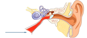 Vospalenie sluhovoj truby 300x131 1 - Особенности лечения заболеваний уха: виды капель, что лучше, отинум или отипакс