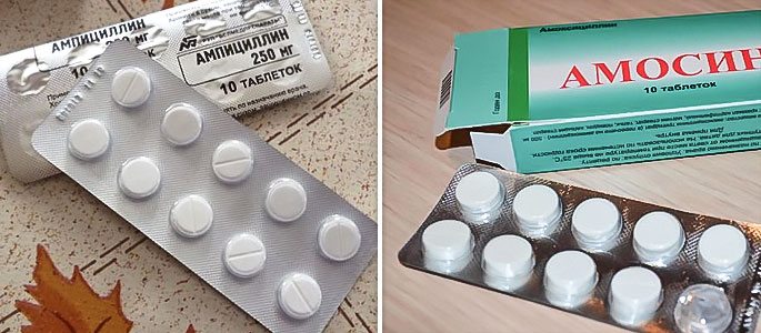 antibiotikipriotiteudeteyivzroslixvazhni 474C5A3B - Эффективное лечение отита у взрослых антибиотиками