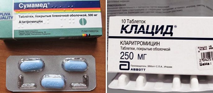 antibiotikipriotiteudeteyivzroslixvazhni BD1812DE - Эффективное лечение отита у взрослых антибиотиками